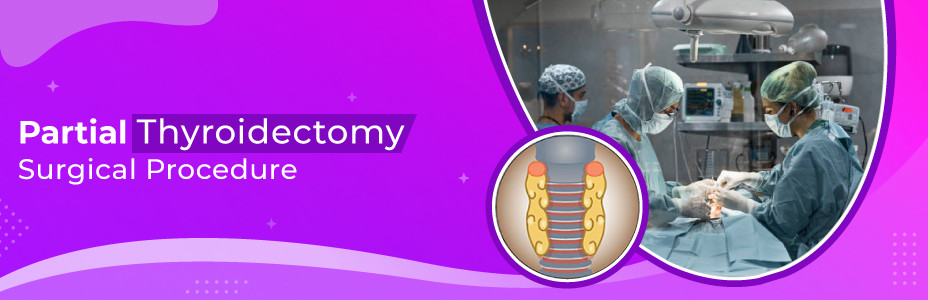 Partial Thyroidectomy Surgical Procedure