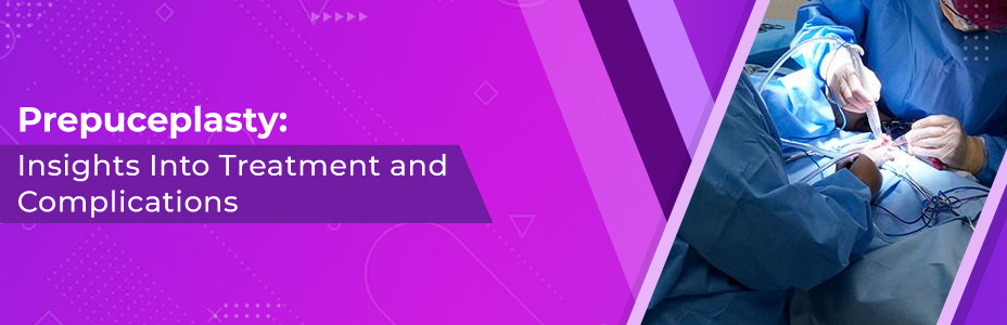 Prepuceplasty: A Detailed Insights Into Treatment and Complications