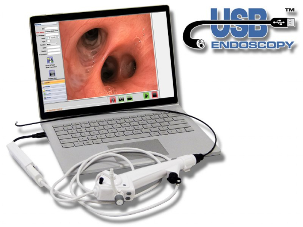disp-vet-usb-video-bronchoscope-28mm-x-60cm-12mm-chanl-brd-1pf-laptop-287-detail-1755547476.jpg