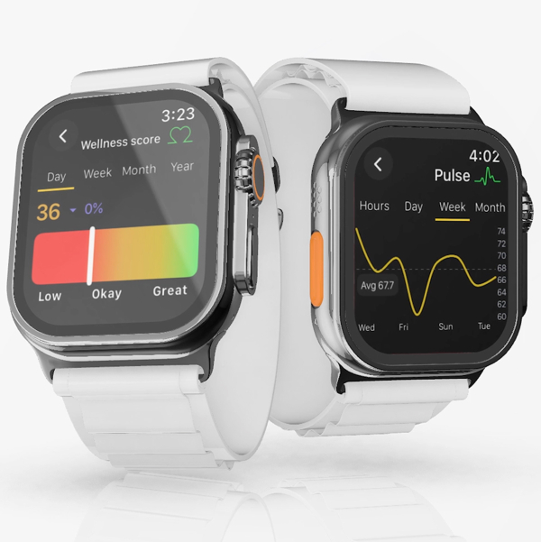petpace-health-monitoring-collar-and-veterinarian-platform-apple-watch-1786524849.jpg